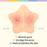 OOTD Star Spot Patch 12mm x 80 patches - Umma Bear Shop